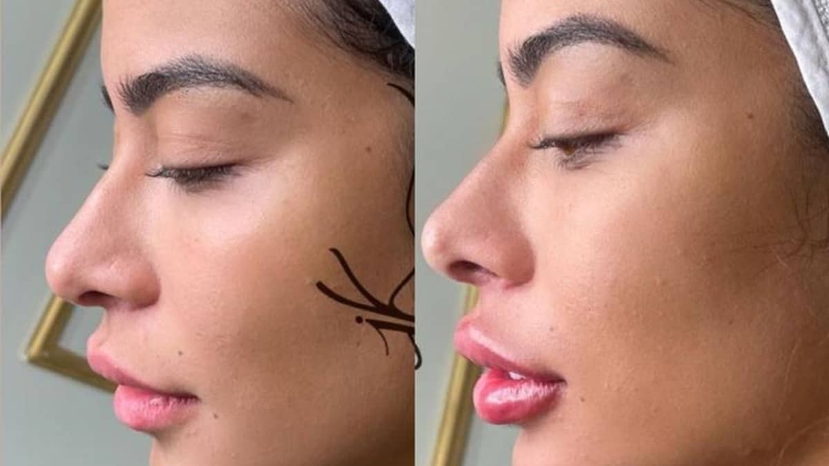 Antes e depois de Rafaella Santos (Foto: Reprodução/Instagram)