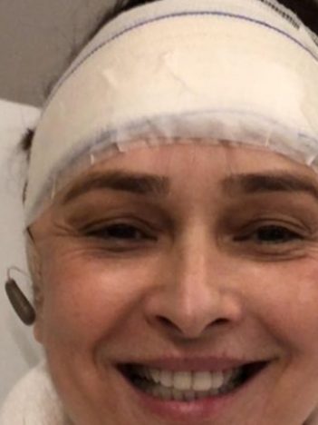 Myrian Rios passou por cirurgia na cabeça para tratar problema (Foto: Reprodução/Instagram)