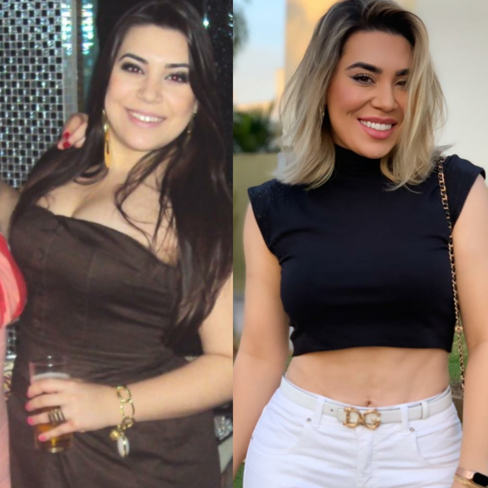Naiara Azevedo antes e depois de perder 30 kg