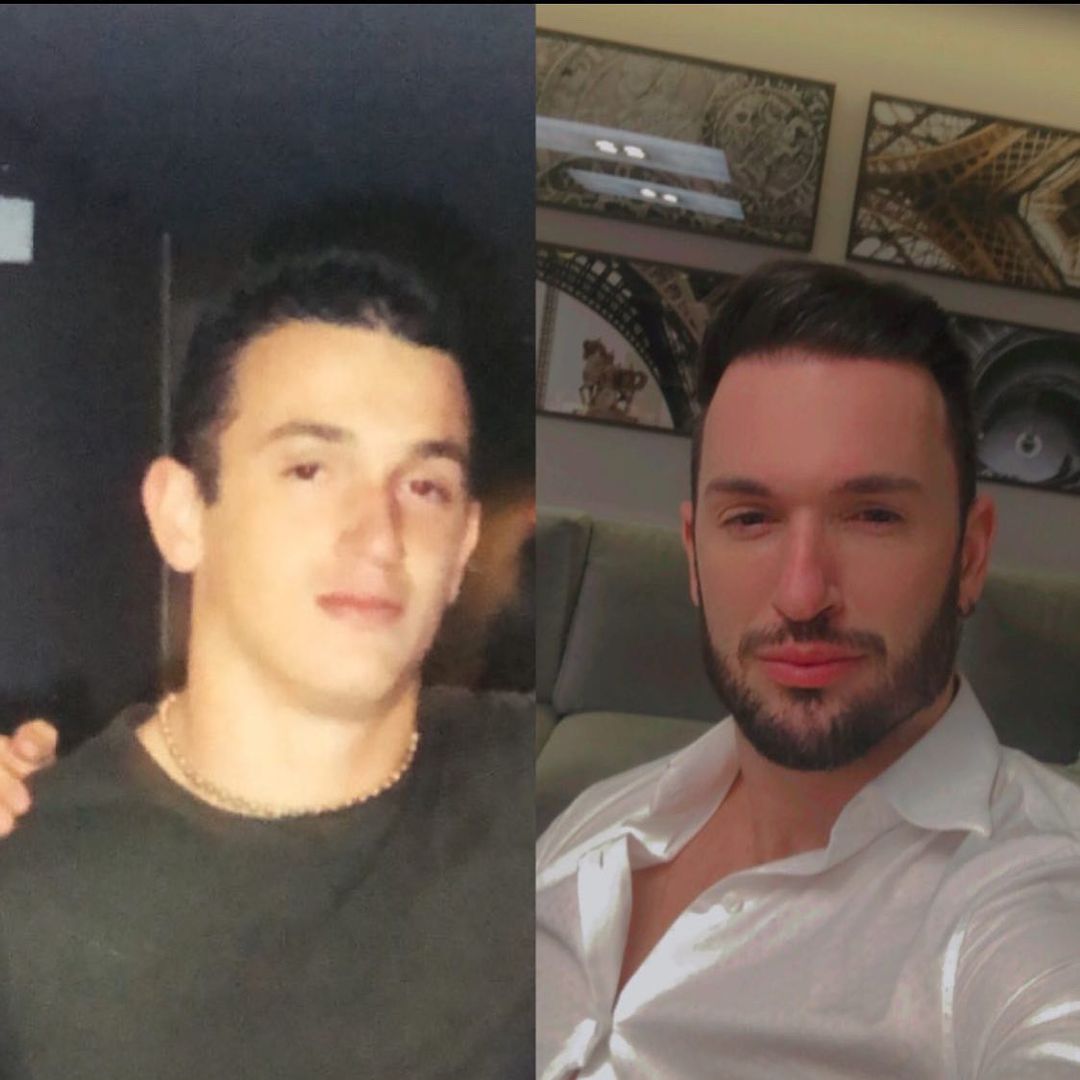 Diego Hypolito antes e depois (Fotos: Reprodução/Instagram)