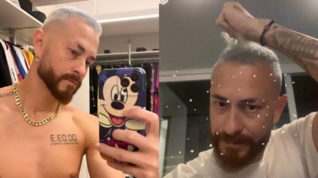 Ex de Boca Rosa tem problema no cabelo após procedimento químico Fred