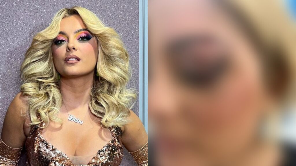 Bebe Rexha mostra corte no rosto após algo INACREDITÁVEL acontecer em show Bebe Rexha