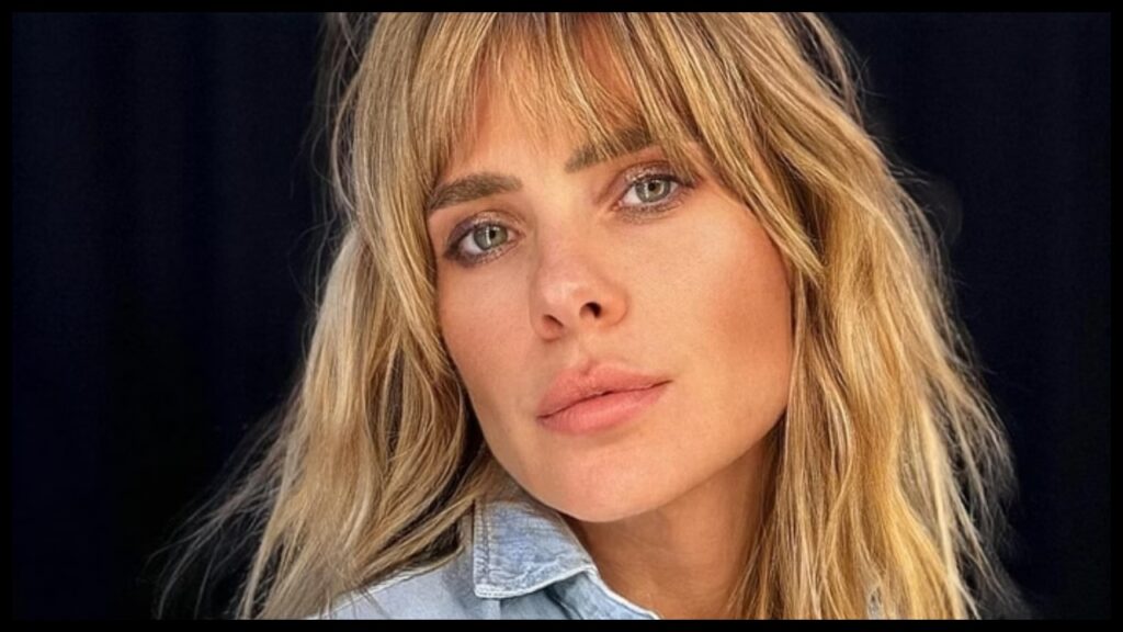 Carolina Dieckmann mostra machucados após acidente carolina dieckmann mostra machucados apos acidente
