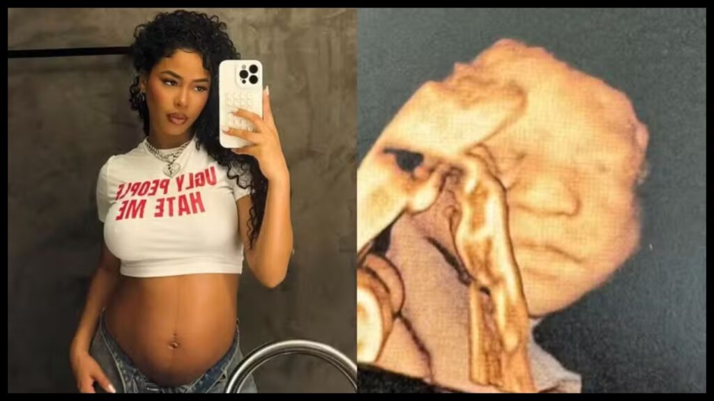 Lorena Maria publica ultrassom com rosto de seu filho lorena maria publica ultrassom com rosto de seu filho