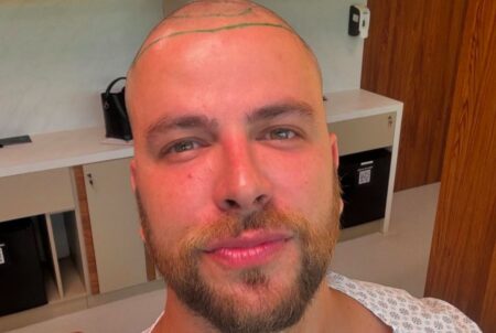 Médico faz alerta sobre procedimento do ex-BBB Gustavo Marsengo