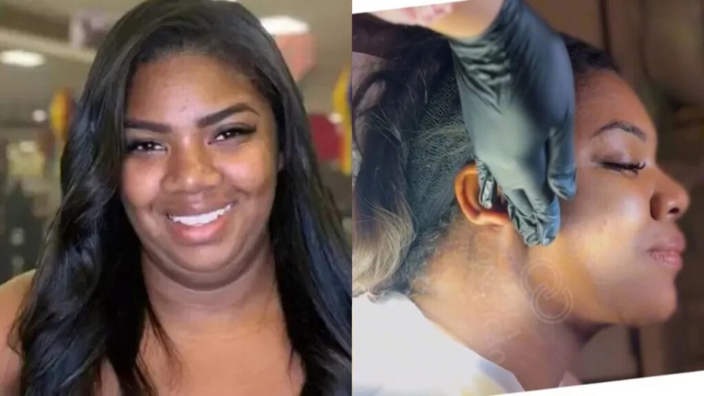 Raquel Brito comemora realização de lipo de papada Raquel Brito
