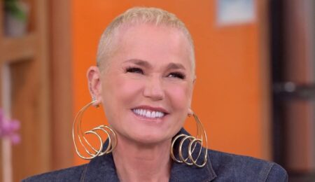 Xuxa revela cirurgia de 12 horas na cabeça e diz que ficará careca Xuxa revela cirurgia de 12 horas na cabeça e diz que ficará careca