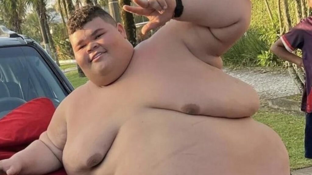 Gordão da XJ, que perdeu 73 kg, afirma que tem medo de cirurgia bariátrica Gordão da XJ, que perdeu 73 kg, afirma que tem medo de cirurgia bariátrica