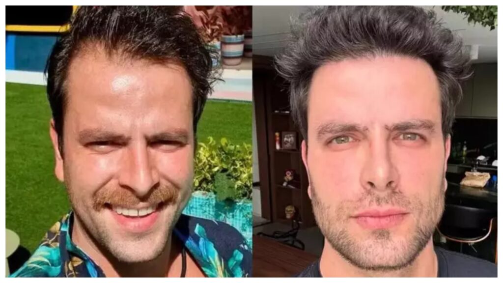 ex bbb gustavo surge irreconhecivel apos mudancas no visual