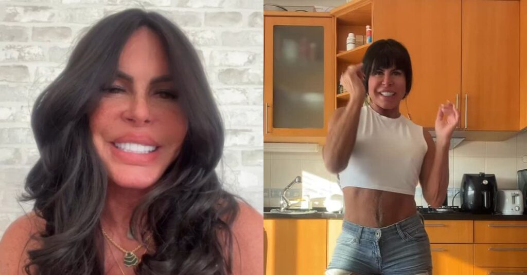 Nova fase! Gretchen remove preenchimento labial e afirma: ‘Ficou perfeita’ Gretchen