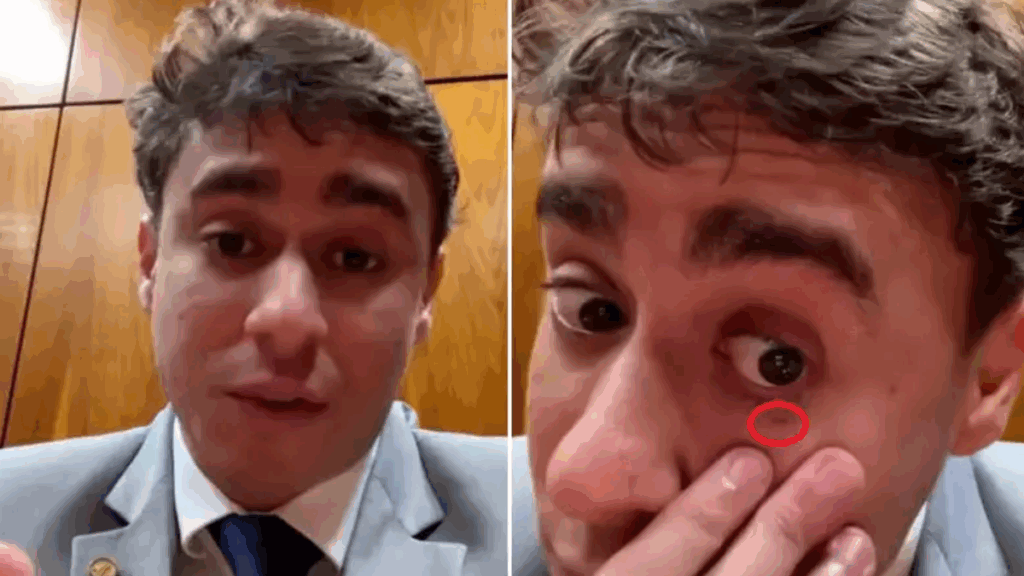 VÍDEO: Nikolas Ferreira é ferido no rosto durante tumulto com Bolsonaro; veja o momento VÍDEO: Nikolas Ferreira é ferido no rosto durante tumulto com Bolsonaro; veja o momento