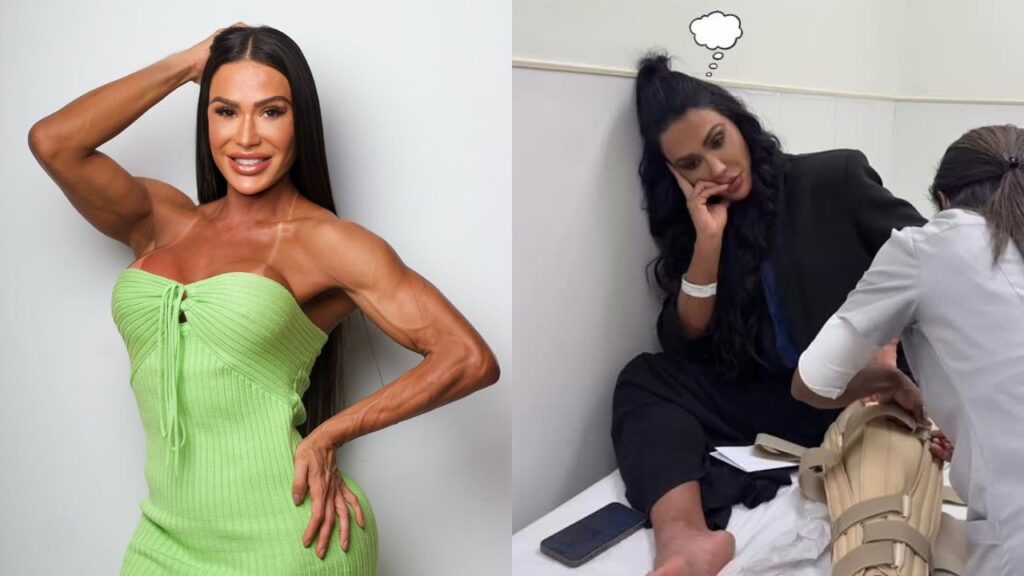 Gracyanne Barbosa se manifesta após lesão no joelho: ‘frustrada’ Montagem de duas fotos da modelo Gracyanne Barbosa