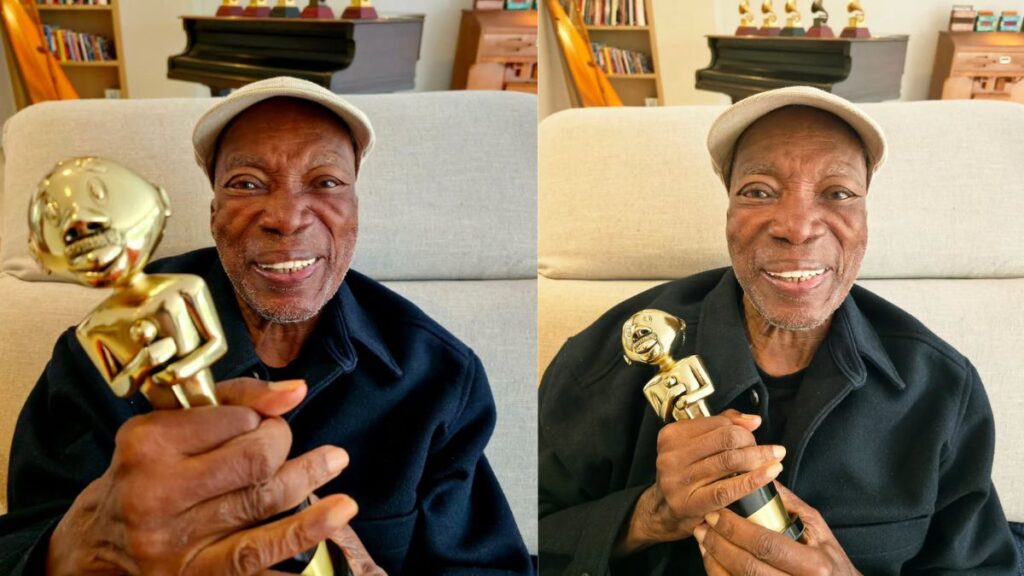 Aos 82 anos, Milton Nascimento recebe diagnóstico de doença neurodegenerativa