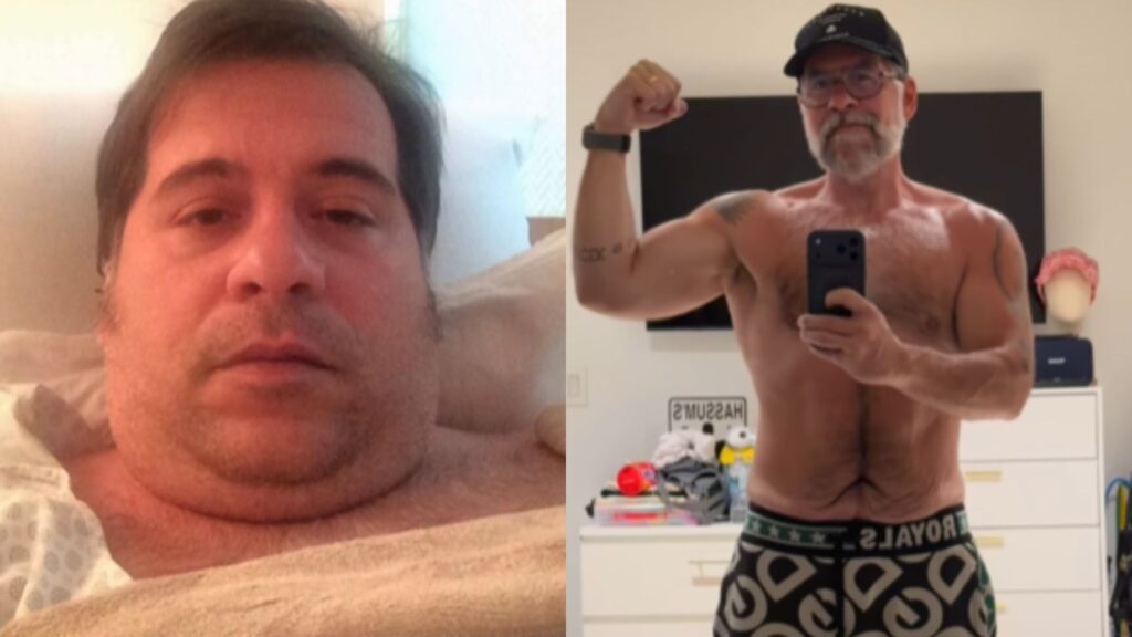 Leandro Hassum celebra 11 anos de bariátrica; antes e depois impressionam 1 Antes e depois de Leandro Hassum fazer bariátrica