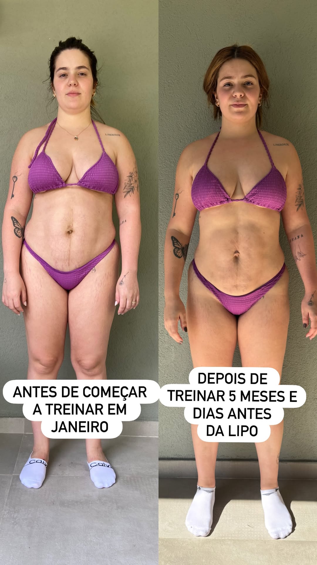 Viih Tube mostra transformação corporal após lipoaspiração; confira