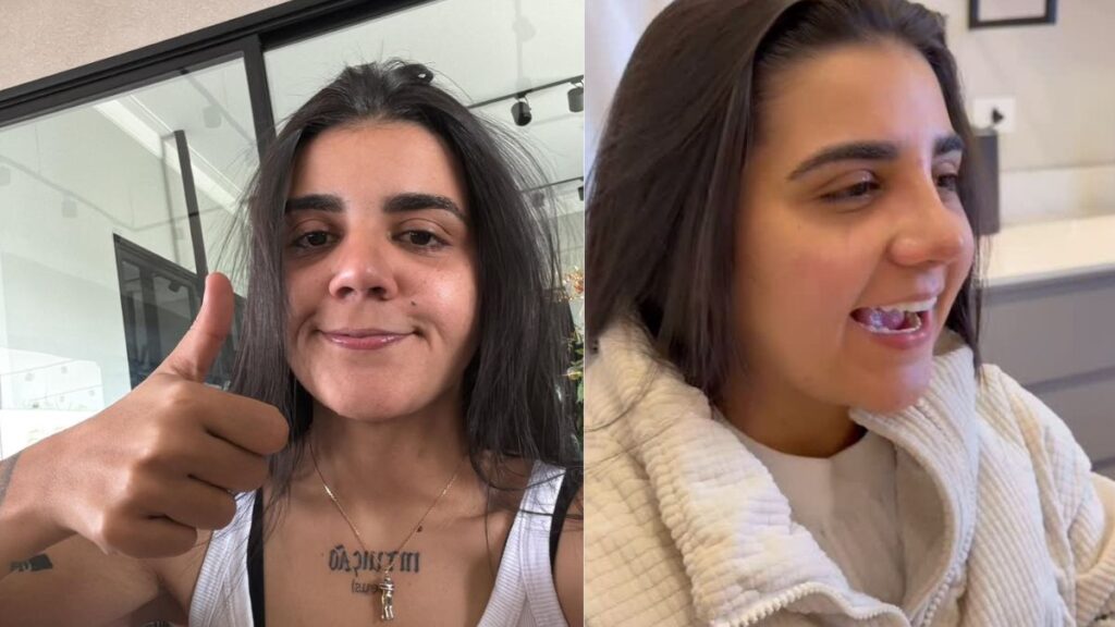 Yasmin Santos se emociona ao ver novo nariz após rinoplastia: ‘Sou outra pessoa’ Yasmin Santos se emociona ao ver novo nariz após rinoplastia; veja o antes e depois