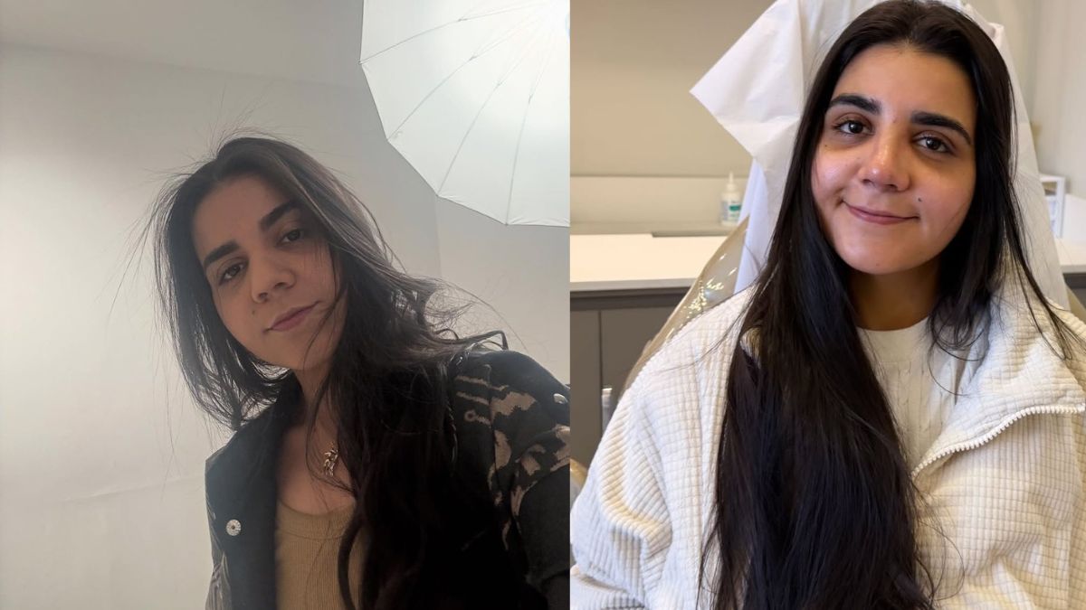 Yasmin Santos se emociona ao ver novo nariz após rinoplastia: 'Sou outra pessoa' 1 Yasmin Santos se emociona ao ver novo nariz após rinoplastia; veja o antes e depois