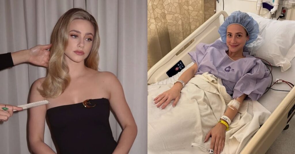 Atriz de Riverdale revela diagnóstico de endometriose e faz alerta Atriz de Riverdale, Lili Reinhart posa em montagem com foto em evento e registro no hospital após cirurgia relacionada ao diagnóstico de endometriose