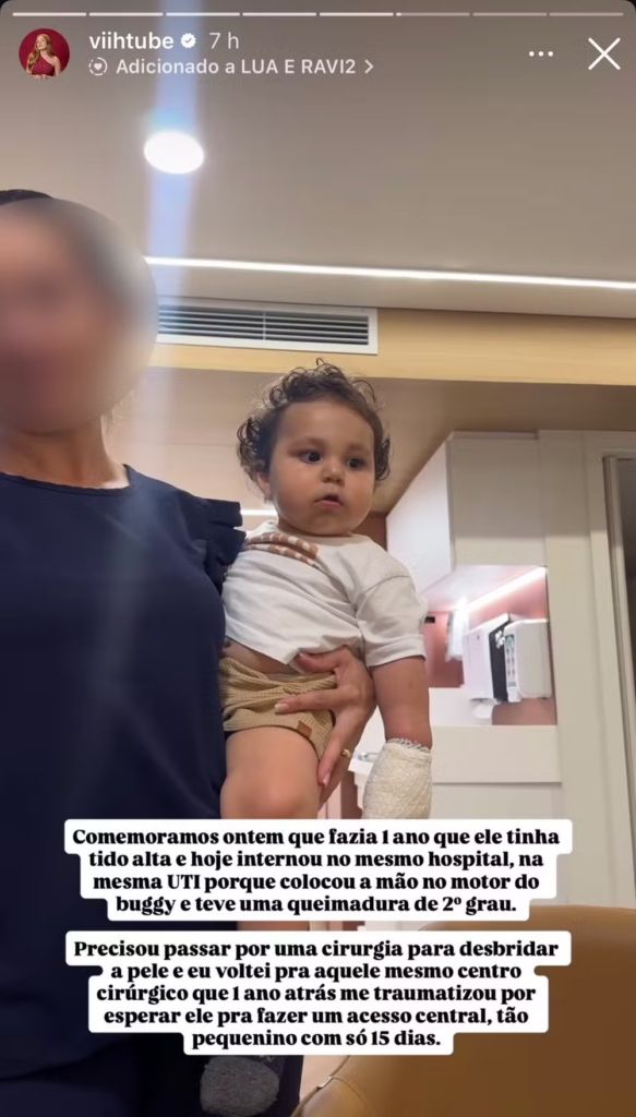 Filho de Viih Tube e Eliezer sofre queimadura grave e passa por cirurgia 3 Imagens fortes! Filho de Viih Tube sofre queimadura grave e passa por cirurgia