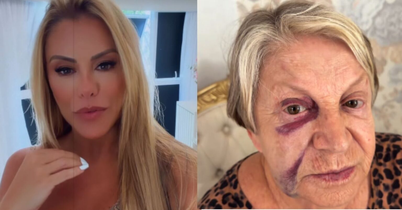 Poliana Rocha em selfie nas redes sociais e, ao lado, sua mãe Eponina, de 84 anos, com hematomas visíveis no rosto após sofrer uma queda em casa