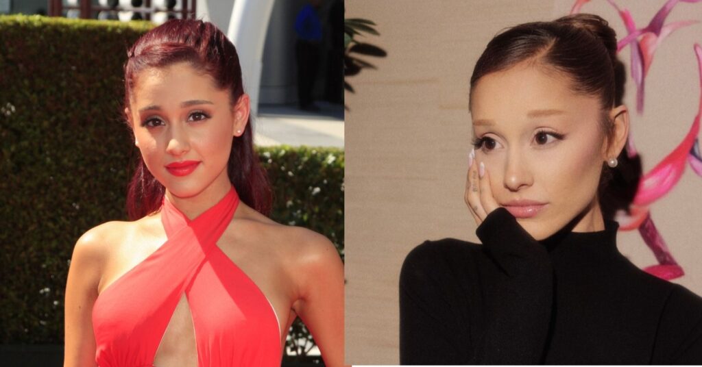 Antes e depois das celebridades: 15 transformações que chocaram 9 antes e depois das celebridades com comparação da transformação estética de Ariana Grande