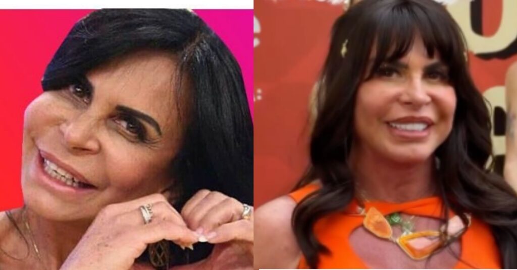 Antes e depois das celebridades: 15 transformações que chocaram 4 antes e depois das celebridades destacando as transformações estéticas de Gretchen