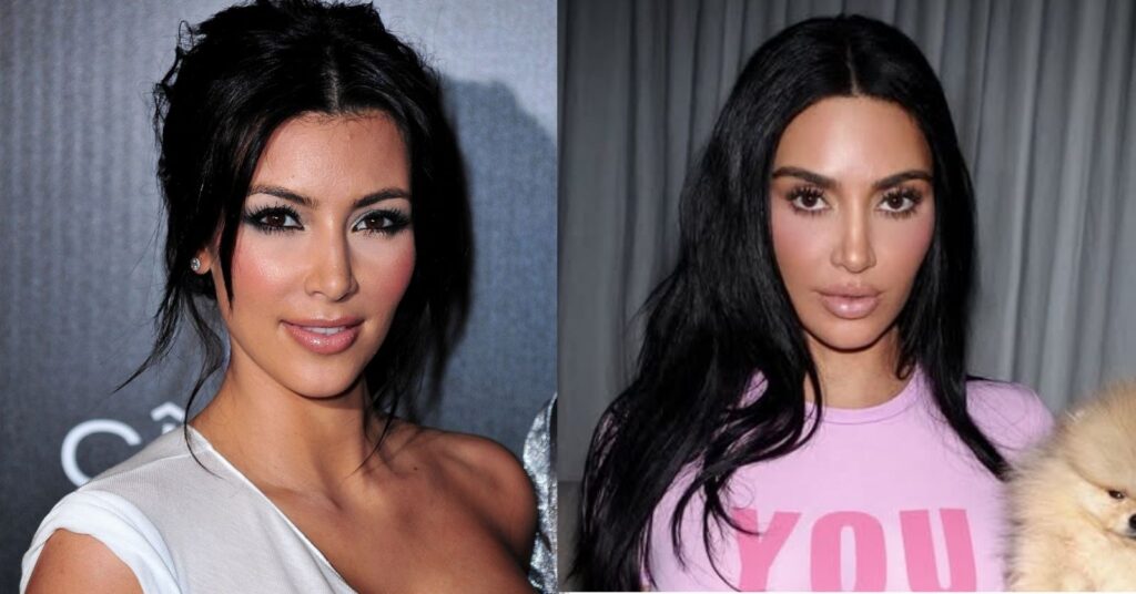 Antes e depois das celebridades: 15 transformações que chocaram 8 antes e depois das celebridades destacando a transformação facial de Kim Kardashian