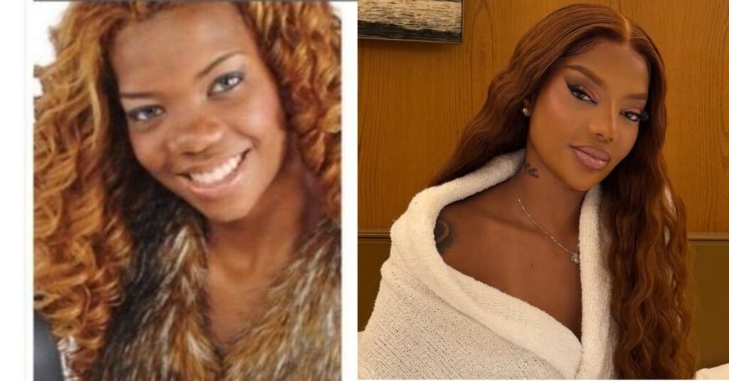 Antes e depois das celebridades: 15 transformações que chocaram 2 antes e depois das celebridades mostrando a evolução estética de Ludmilla