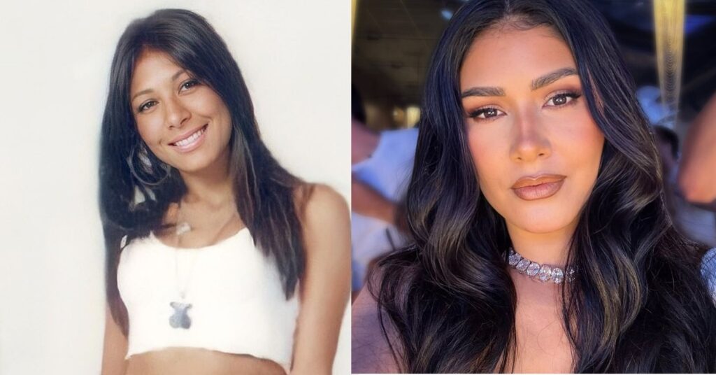 Antes e depois das celebridades: 15 transformações que chocaram 5 antes e depois das celebridades com comparação da harmonização facial de Simaria