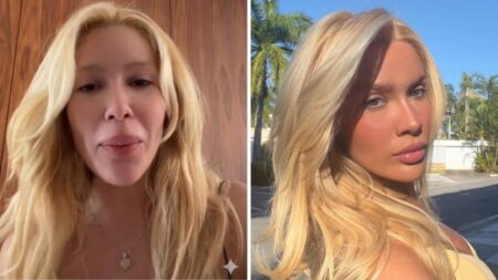Karoline Lima aparece com olhos inchados após choro em vídeo publicado nos stories.