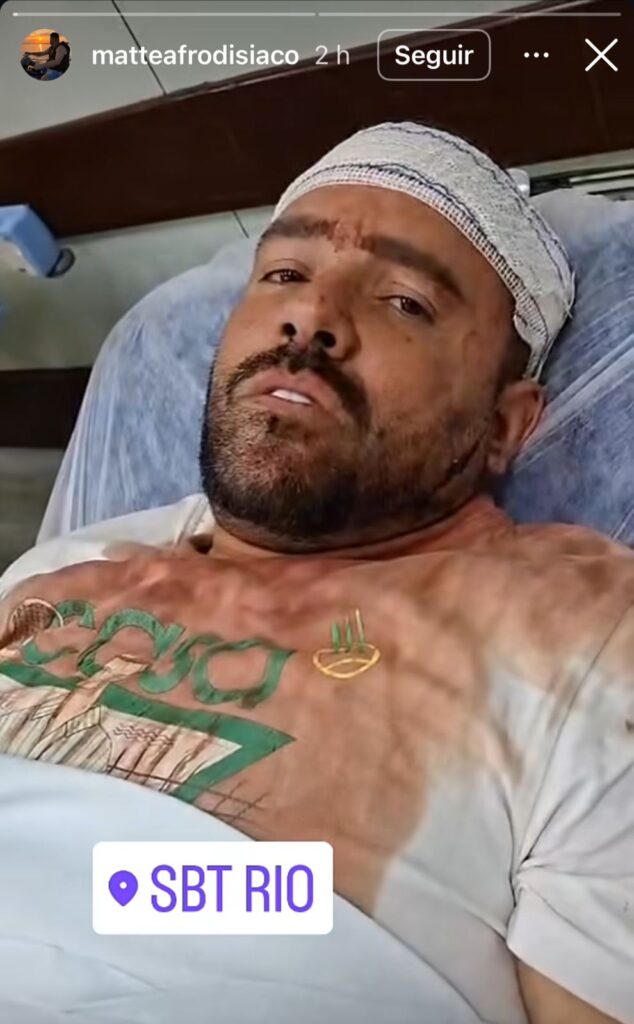 Amigo de Orochi detalha briga em boate no Rio de Janeiro: ‘quebramos tudo’ 6 Homem com curativo na cabeça deitado em maca, com marcas no rosto e peito, em ambiente hospitalar.