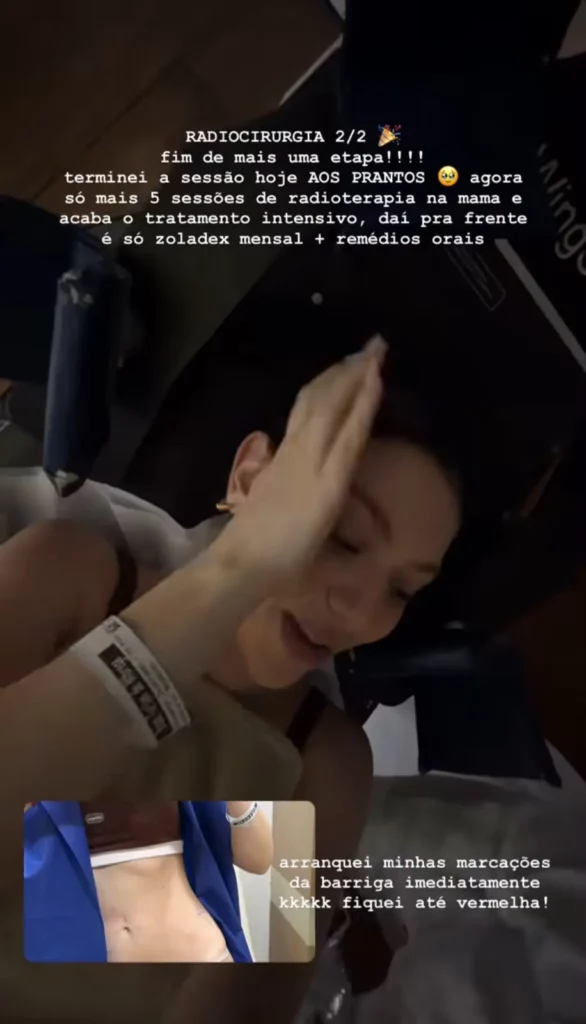 Bruna Furlan registra o momento após concluir a última sessão de radiocirurgia em publicação nas redes sociais, emocionada por encerrar mais uma fase do tratamento contra o câncer.
