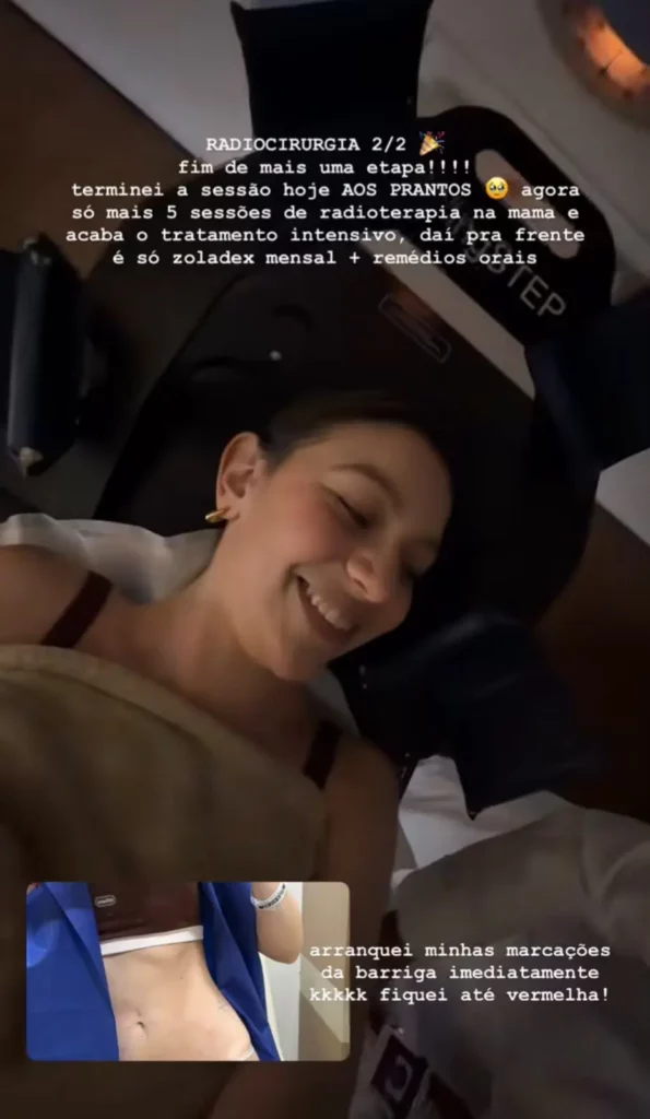 Bruna Furlan aparece sorrindo durante a sessão de radiocirurgia em foto publicada nas redes sociais, na qual comemora a conclusão do procedimento e explica as próximas etapas do tratamento.