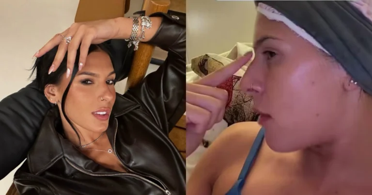 Ana Castela abandona ideia de silicone e revela detalhe do rosto que quer mudar Ana Castela aparece em montagem com foto nas redes sociais e imagem em que aponta para o nariz ao falar sobre procedimento estético.