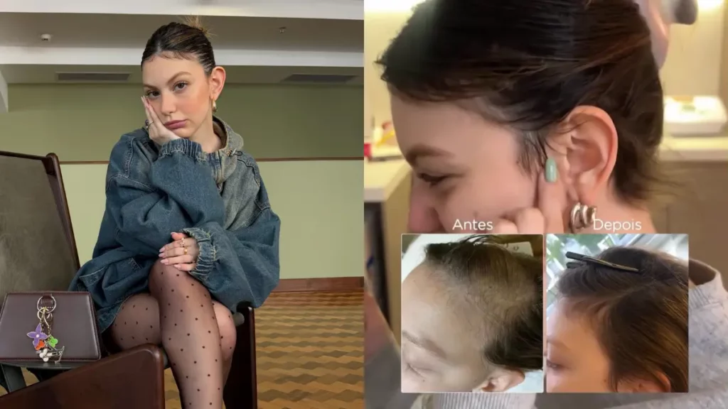 Neta de Carlos Alberto de Nóbrega se emociona com crescimento do cabelo após câncer; veja Bruna Furlan aparece em foto e mostra a evolução do crescimento dos cabelos após o tratamento contra o câncer.