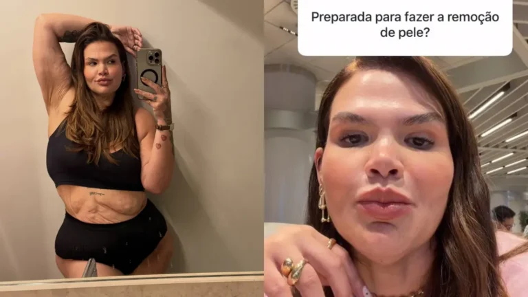 Thais Carla aparece em duas fotos: à esquerda, posa diante do espelho mostrando o corpo após o emagrecimento; à direita, responde sobre a remoção de pele.