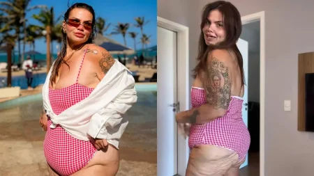 Montagem de Thais Carla em maiô xadrez rosa: à esquerda, a influenciadora posa durante passeio ao ar livre; à direita, mostra o corpo de perfil e o excesso de pele após perder 120 kg.